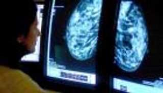 دراسة: العمل يعالج سرطان الثدي.. كيف؟