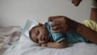 دراسة تعضّد علاقة السببية بين زيكا وتشوهات مخ الأجنّة