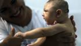 تراجع الإصابات المؤكدة بتشوه الأجنة بسبب زيكا في البرازيل