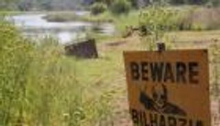 البلهارسيا مفتاح اللغز في مكافحة الإيدز