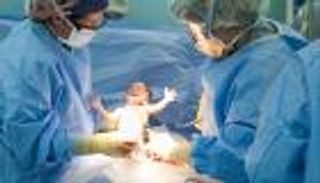 لماذا يقبل النساء عليها؟.. تحذيرات من اللجوء السهل للولادة القيصرية