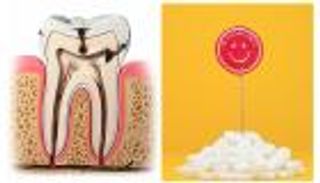 خلافا لمعلوماتكم.. الأطعمة الخالية من السكر ليست أفضل لصحة الأسنان