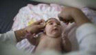 سنغافورة بؤرة فيروس زيكا في آسيا