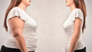 البالونات.. ثورة في تصغير المعدة والتخلص من السمنة دون جراحة