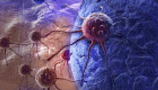 رسومات ثلاثية الأبعاد للأورام الخبيثة في أضخم قاعدة بيانات لعلاج السرطان