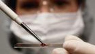 مسؤول: أكثر من مليون مصاب بالإيدز في روسيا