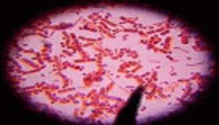 كينيا تعتقل متشددا كان ينوي مهاجمتها بالجمرة الخبيثة