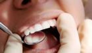 أمراض اللثة قد تنبئ بسرعة تدهور حالات الزهايمر