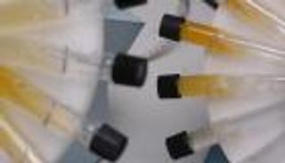 إيقاف لاعب في نيوزيلندا بسبب دواء لعلاج الربو