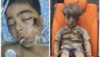 بالفيديو.. شقيق الطفل السوري عمران الذي لم ينصفه العالم