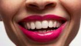 احذر.. 10 أشياء تضر أسنانك دون أن تعلم