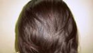 يمنية تدمن أكل شعرها.. ما السبب؟