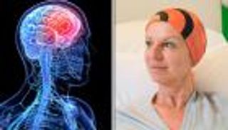 دواء جديد فعال يفتح طاقة الأمل لمرضى سرطان المخ