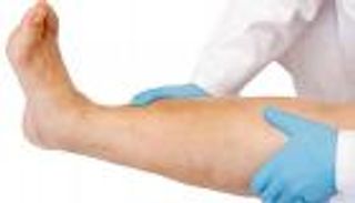 احذر.. التهابات القدم تهدد مرضى السكري بالبتر