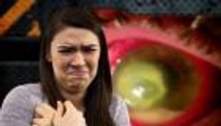 الخبراء يُحذرون:استخدام العدسات اللاصقة باستهتار يُسبب العمى