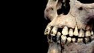 بالفيديو.. تعرف على رفات صاحبة الأسنان المرصعة