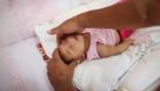 أمريكا تؤكد: فيروس زيكا وراء تشوُّه رؤوس المواليد