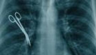 أخطاء الأطباء.. من الإبرة إلى العدوى 