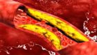 لا تنخدع.. "الكوليسترول الجيد" أيضًا قد يكون ضارًّا لقلبك