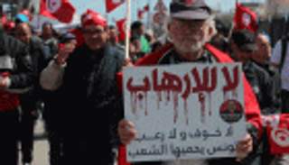 إصابة مدني برصاص 