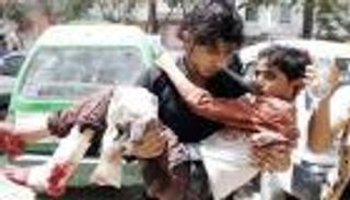 الجبير: التحالف حريص على سلامة المدنيين والأطفال باليمن