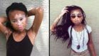 طفلة تواجه البُهاق بالسيلفي وتحلم بالنجومية