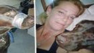 "ثورة" ضد سيدة أخرست كلبها بشريط لاصق