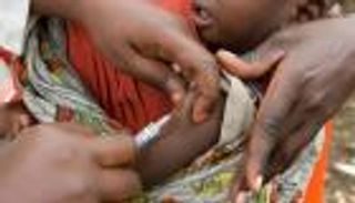 أنجولا تعلن وفاة 51 بـ