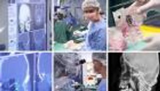 لأول مرة: استخدام تقنية الطباعة 3D لعلاج سرطان العمود الفقري