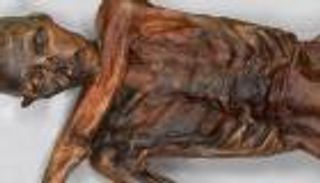 صور.. مومياء عمرها 5300 عام تكشف أسرارًا عن عدوى معوية