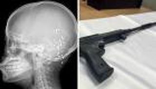 لا تزال حية ترزق.. 36 رصاصة صيد تصيب رأس صينيّة