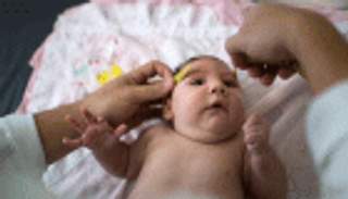 الشيوخ الأمريكي يقترح 3 خطط لتمويل مكافحة زيكا.. ما قيمتها؟