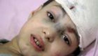 بالصور.. حلب مقبرة الأطفال.. من لم يمت بالقصف مات بالأوبئة