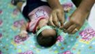 البرازيل تتوقع انحسار زيكا بعد أن اصابت  1.5 مليون شخص