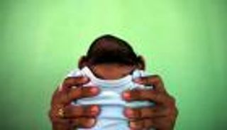 فيتنام تعلن عن أول حالة لصغر حجم الرأس ترتبط بـ"زيكا"