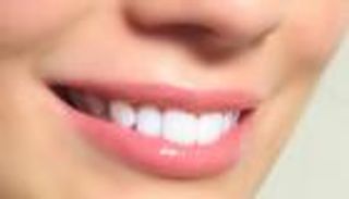 تجميل الأسنان .. 4 طرق للوصول إلى ابتسامة مثالية