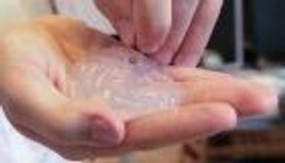 علماء سويسريون يحتفلون بنجاح علاج للشلل