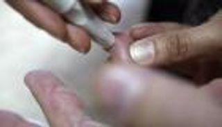 البنكرياس الصناعي آمن لمرضى السكري في المستشفيات