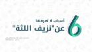 إنفوجراف.. 6 أسباب لا تعرفها عن نزيف اللثة