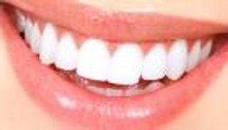 لا تستخدموا هذه الوصفات لتبييض الأسنان