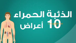 الذئبة الحمراء مرض خطير