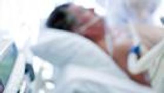 إنفوجراف .. "الموت الدماغي" 