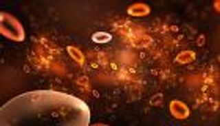 اكتناز الحديد.. 9 معلومات عن أعراض المرض والمواجهة