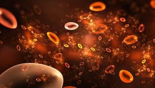 من الصعب تشخيص اكتناز الحديد مبكرا