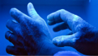 الضوء الأزرق.. سلاح لعلاج هذا المرض