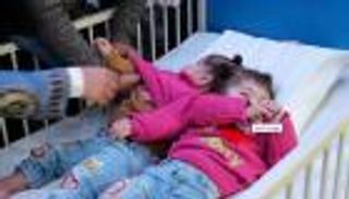 السعودية تفصل توائم 14 دولة حول العالم