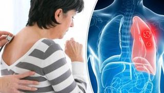 خريطة تفصيلية لسرطان الرئة في بريطانيا