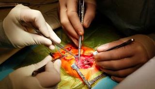 هذا الإجراء العلاجي يعزز إصابات المخ