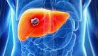 دهون الكبد تعرضك لهذه الكوارث