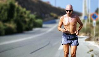 الصلع لم يعد سببا للإحراج